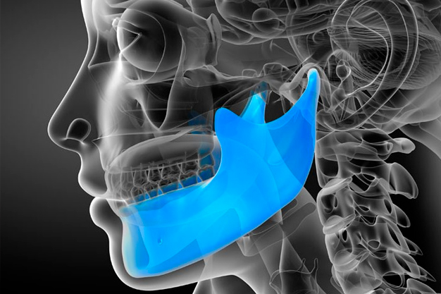 Raio-x de um crânio humano com destaque no maxilar