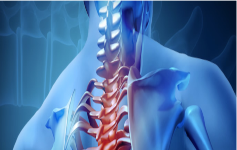 Imagem de uma coluna vertebral